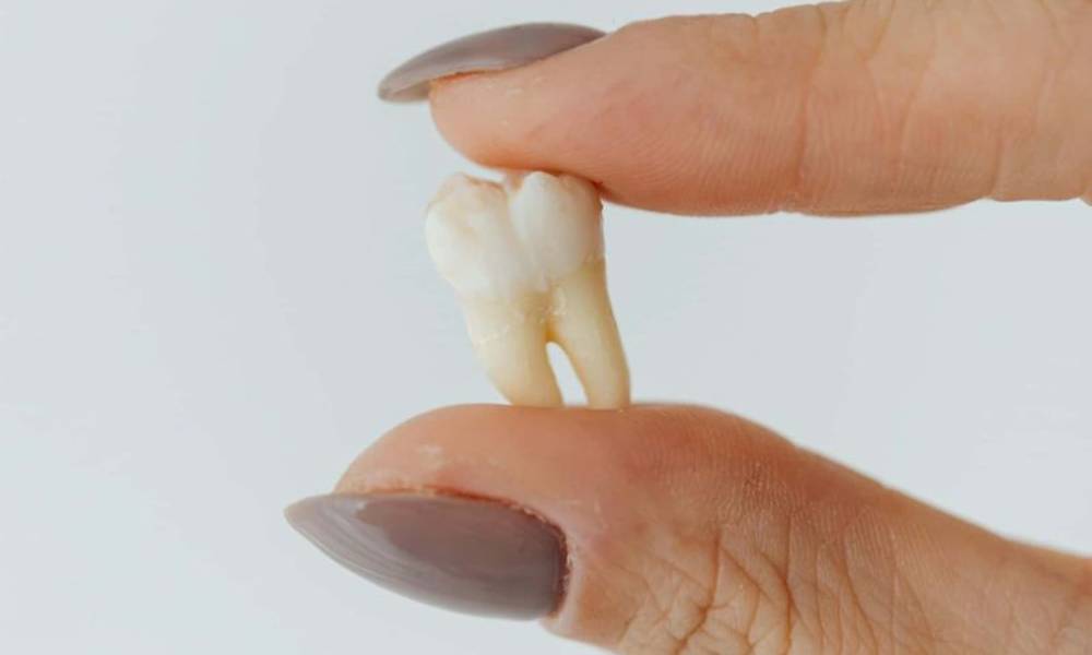 tooth extraction
