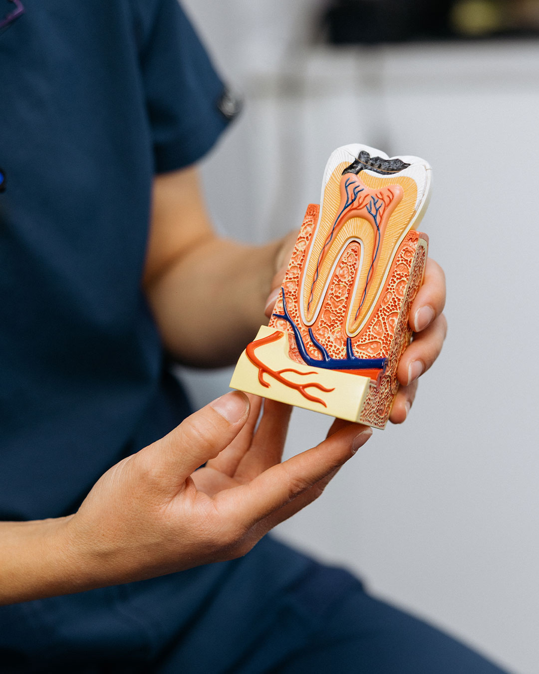 Root-Canal-Treatment-Notting-hill
