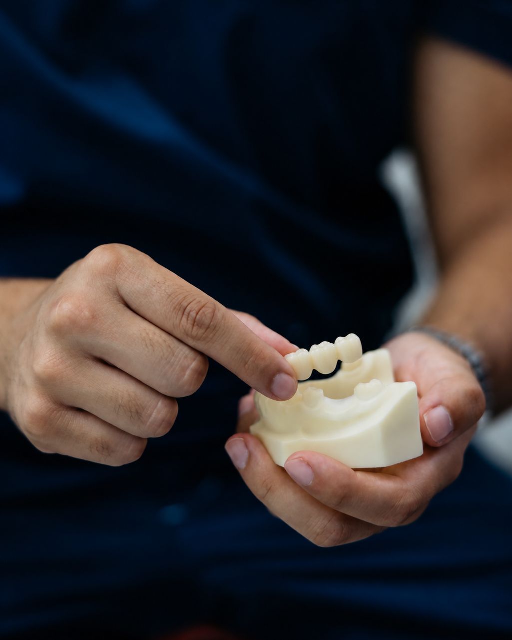 dental-bridge-treatment-notting-hill