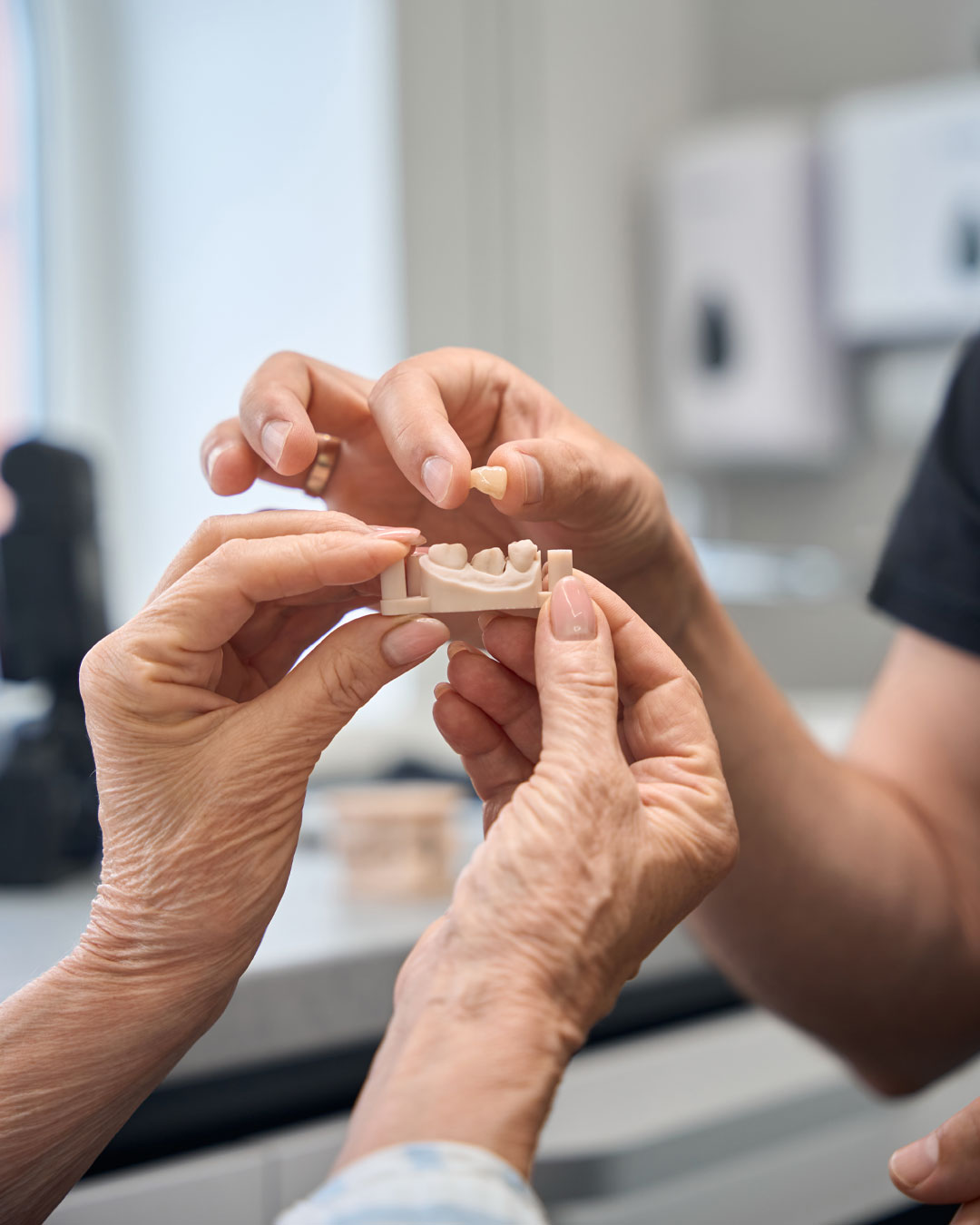 dental-crowns-london